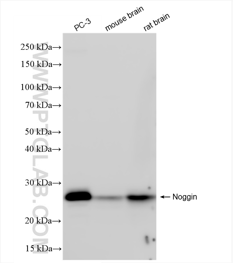 Western Blot (WB) analysis of various lysates using Noggin Recombinant antibody (84283-5-RR)