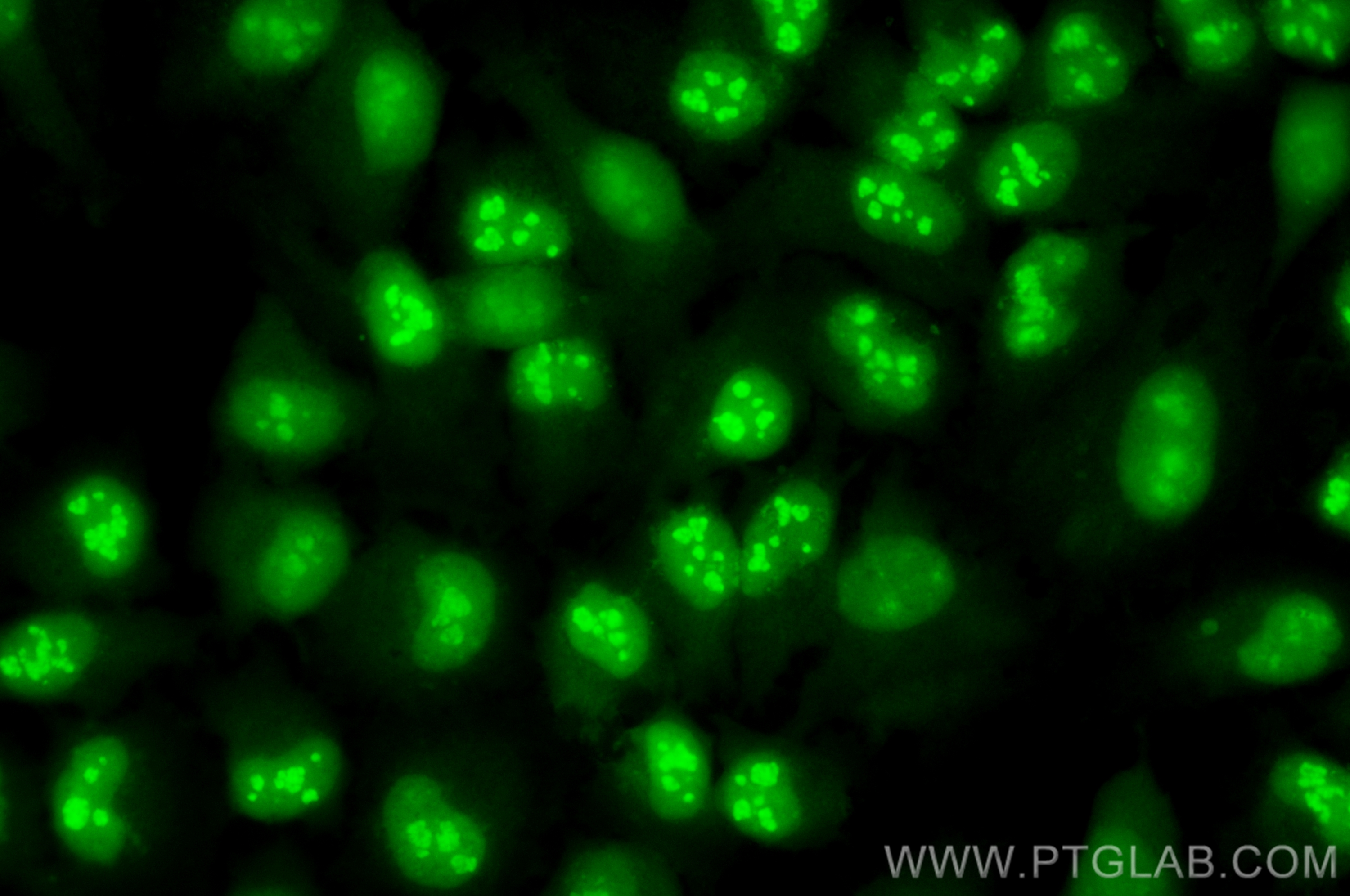 Nucleolin/C23