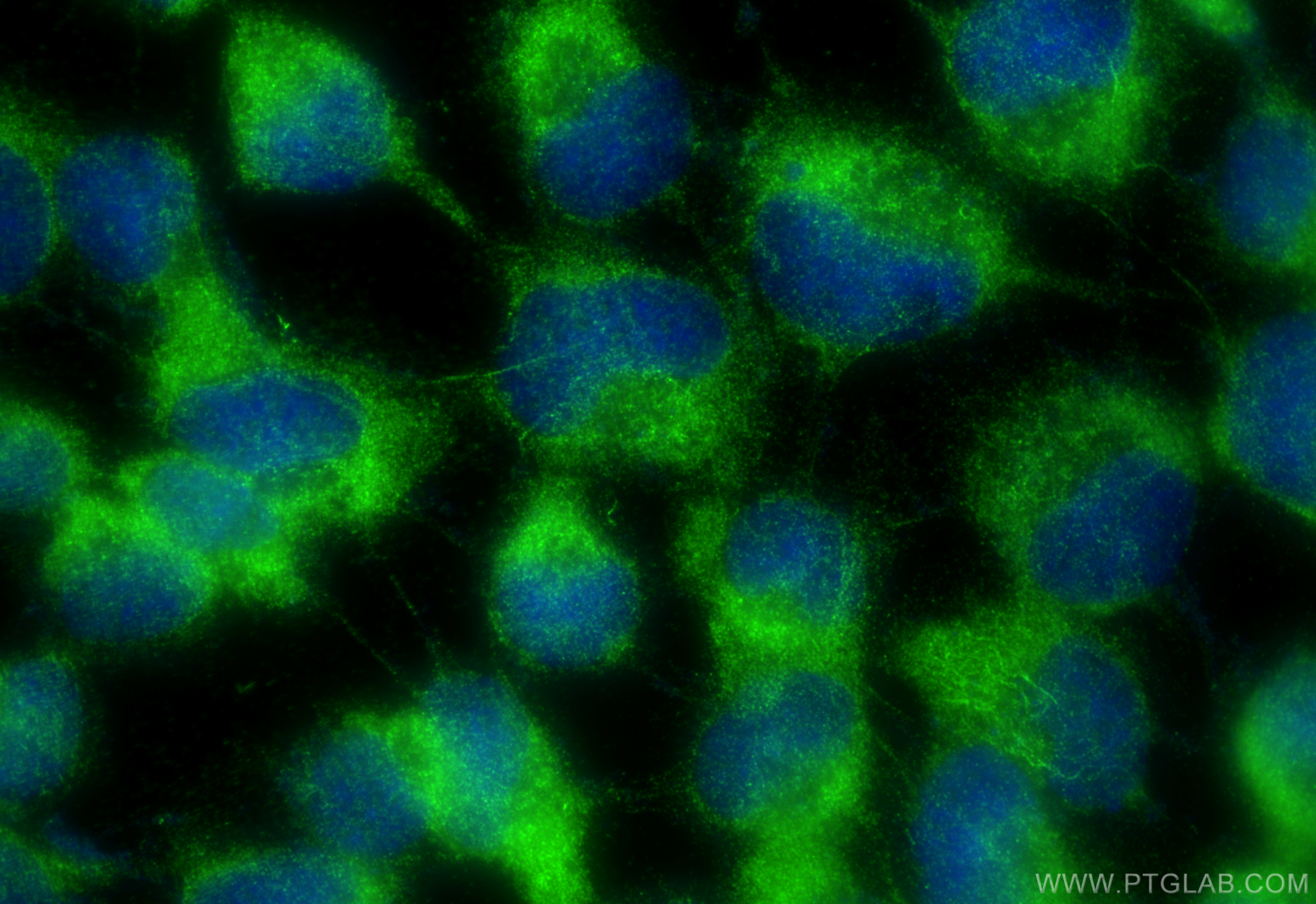 Immunofluorescence (IF) / fluorescent staining of A431 cells using OAS1/3 Polyclonal antibody (14955-1-AP)