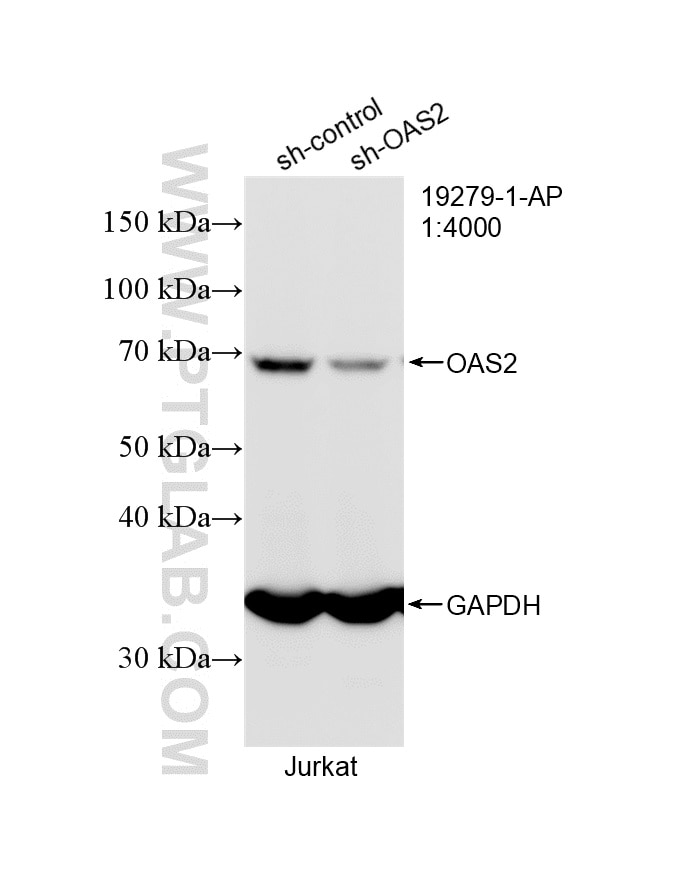 Western Blot (WB) analysis of Jurkat cells using OAS2 Polyclonal antibody (19279-1-AP)