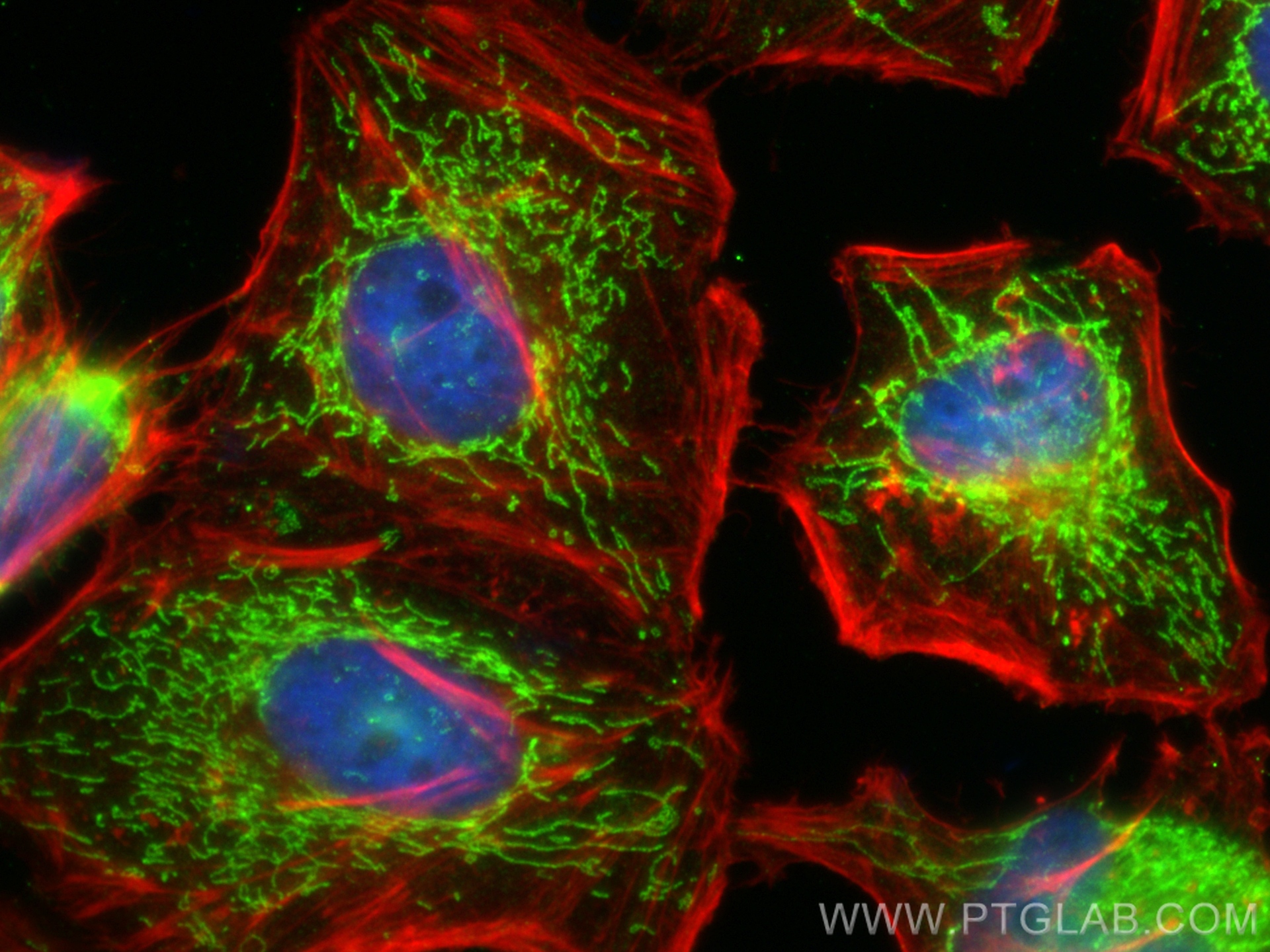 Immunofluorescence (IF) / fluorescent staining of HeLa cells using OAT Polyclonal antibody (17089-1-AP)