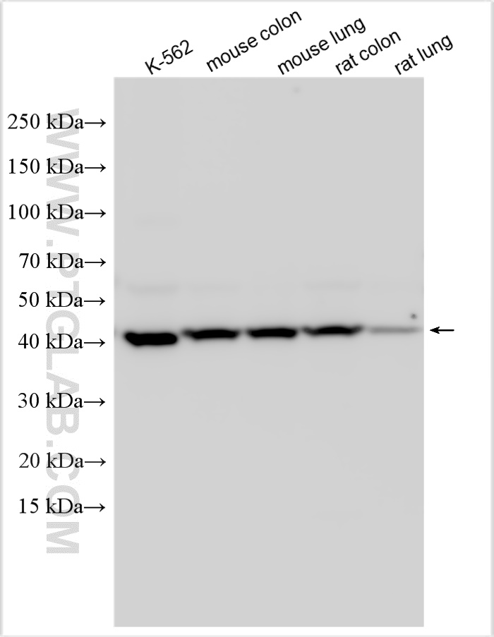 Western Blot (WB) analysis of various lysates using OAT Polyclonal antibody (17089-1-AP)