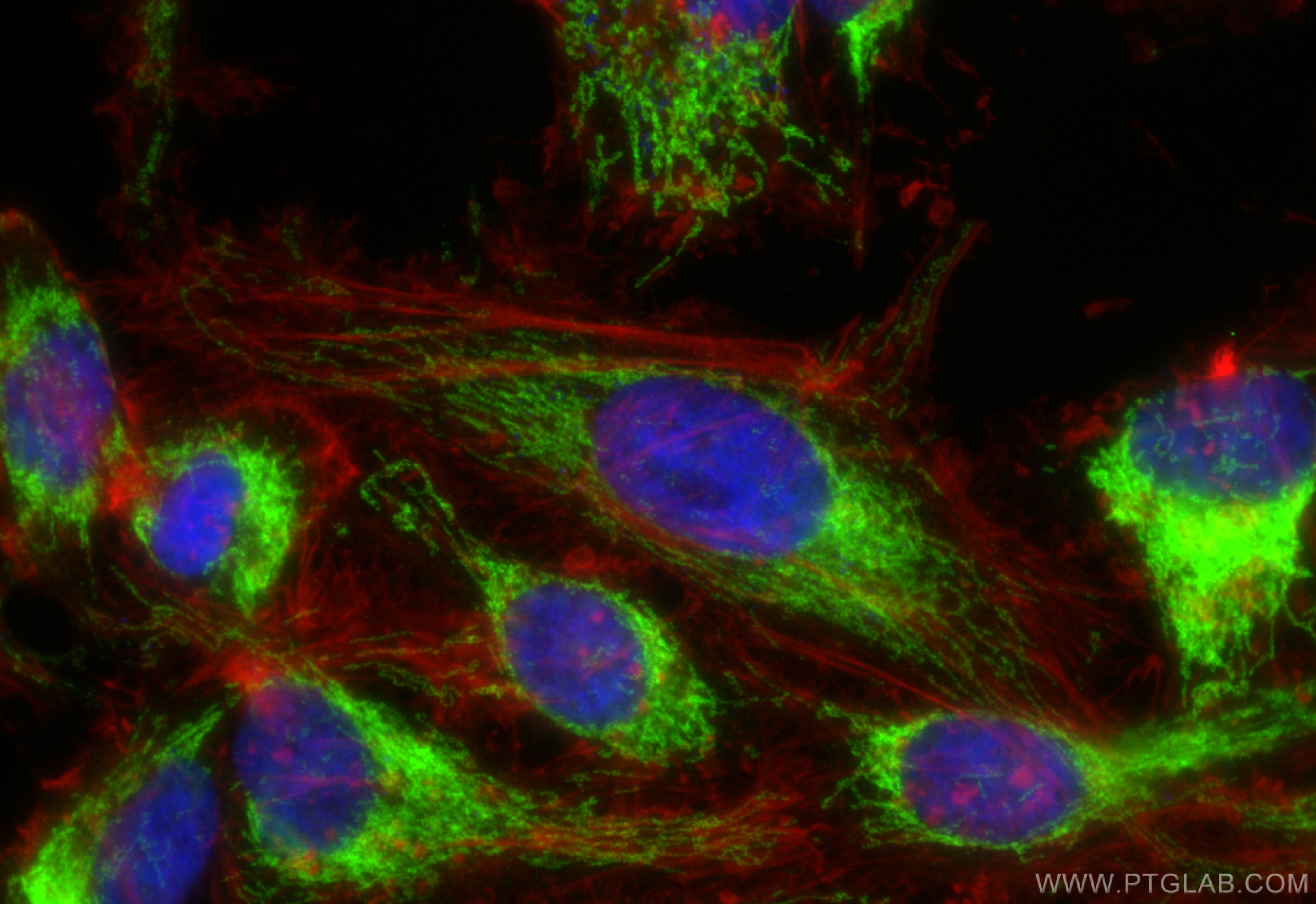 Immunofluorescence (IF) / fluorescent staining of HeLa cells using OCIAD1 Polyclonal antibody (16634-1-AP)