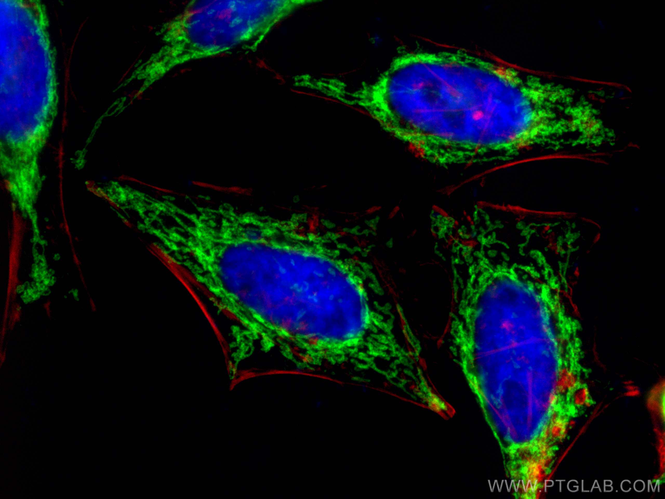 Immunofluorescence (IF) / fluorescent staining of HeLa cells using OCIAD1 Monoclonal antibody (66698-1-Ig)