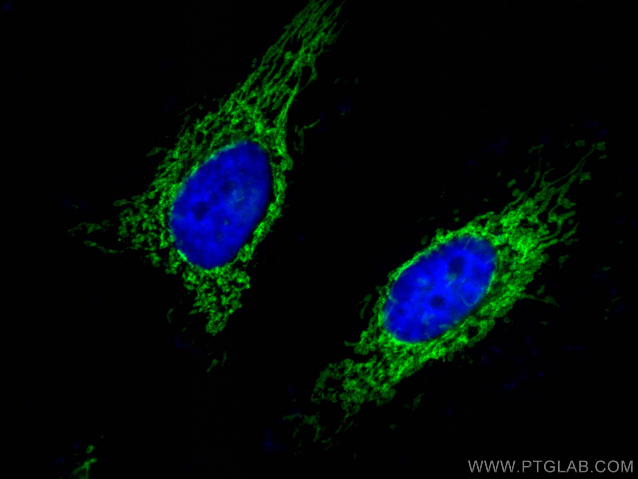 Immunofluorescence (IF) / fluorescent staining of HeLa cells using CoraLite® Plus 488-conjugated OCIAD1 Monoclonal an (CL488-66698)