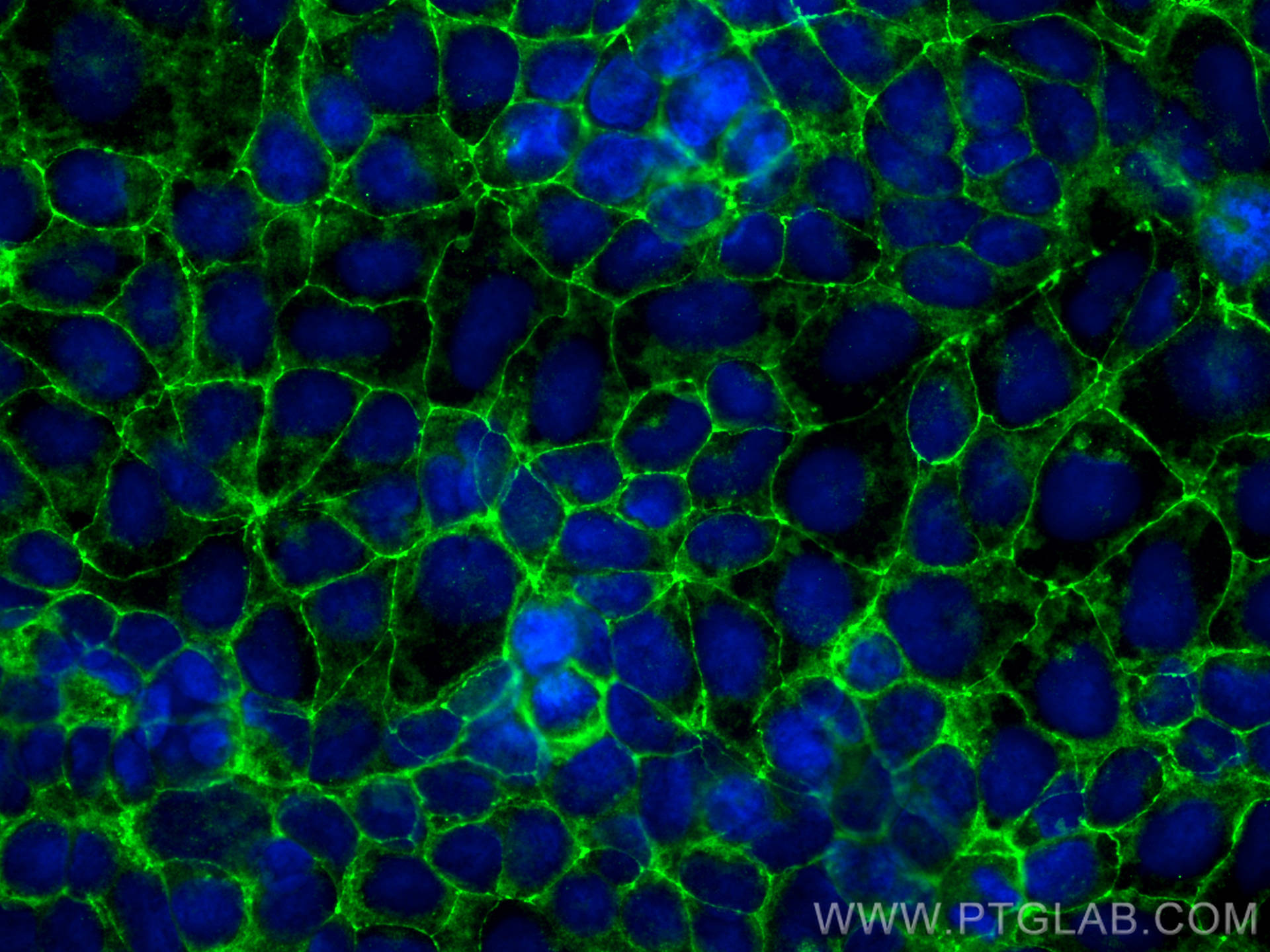 Immunofluorescence (IF) / fluorescent staining of Caco-2 cells using Occludin Polyclonal antibody (13409-1-AP)