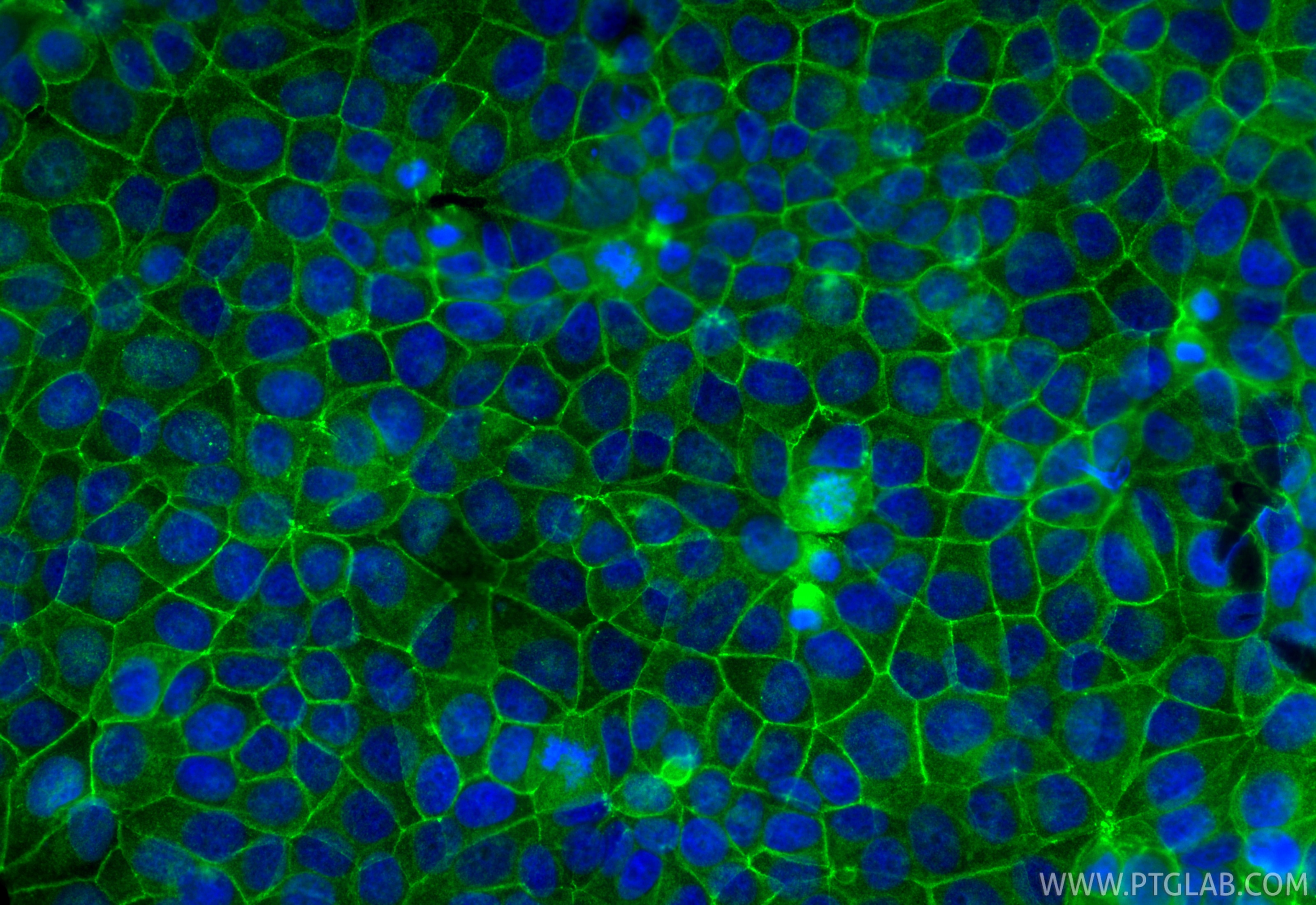 Immunofluorescence (IF) / fluorescent staining of MCF-7 cells using Occludin Polyclonal antibody (13409-1-AP)
