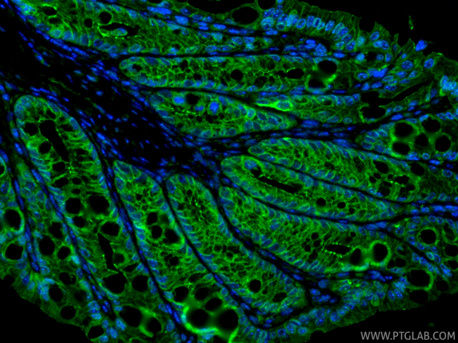 Immunofluorescence (IF) / fluorescent staining of mouse colon tissue using Occludin Polyclonal antibody (13409-1-AP)