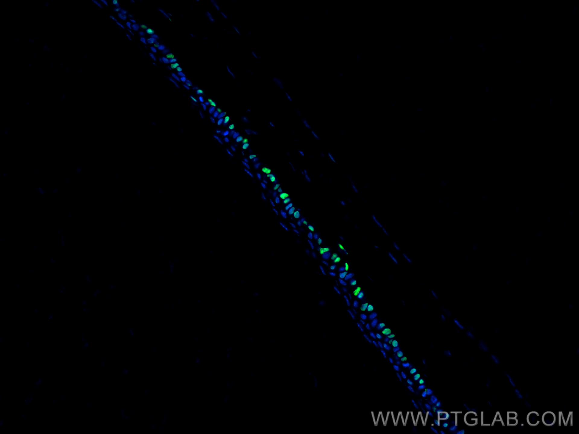 Immunofluorescence (IF) / fluorescent staining of mouse eye tissue using OCT4/POU5F1 Polyclonal antibody (11263-1-AP)