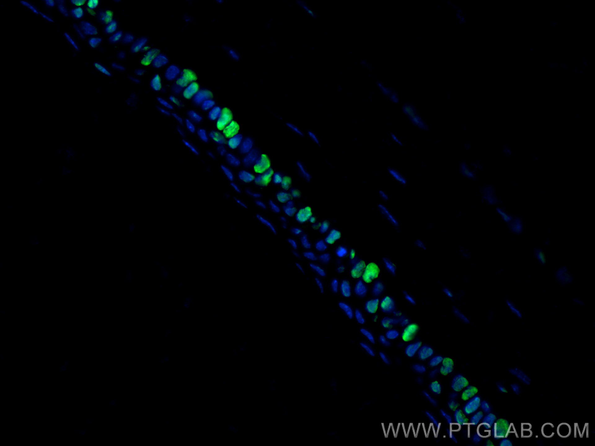 Immunofluorescence (IF) / fluorescent staining of mouse eye tissue using OCT4/POU5F1 Polyclonal antibody (11263-1-AP)