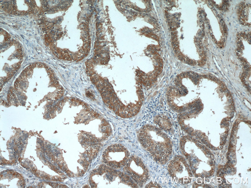 Immunohistochemistry (IHC) staining of human prostate hyperplasia tissue using ODC1 Polyclonal antibody (23454-1-AP)