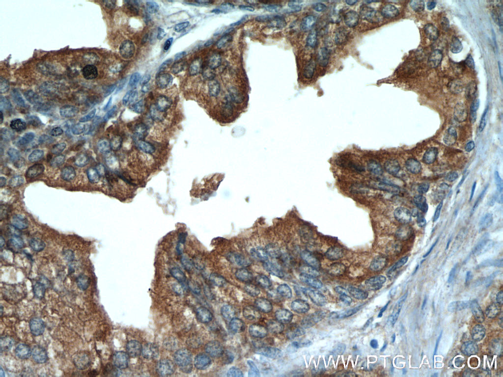 Immunohistochemistry (IHC) staining of human prostate hyperplasia tissue using ODC1 Polyclonal antibody (23454-1-AP)