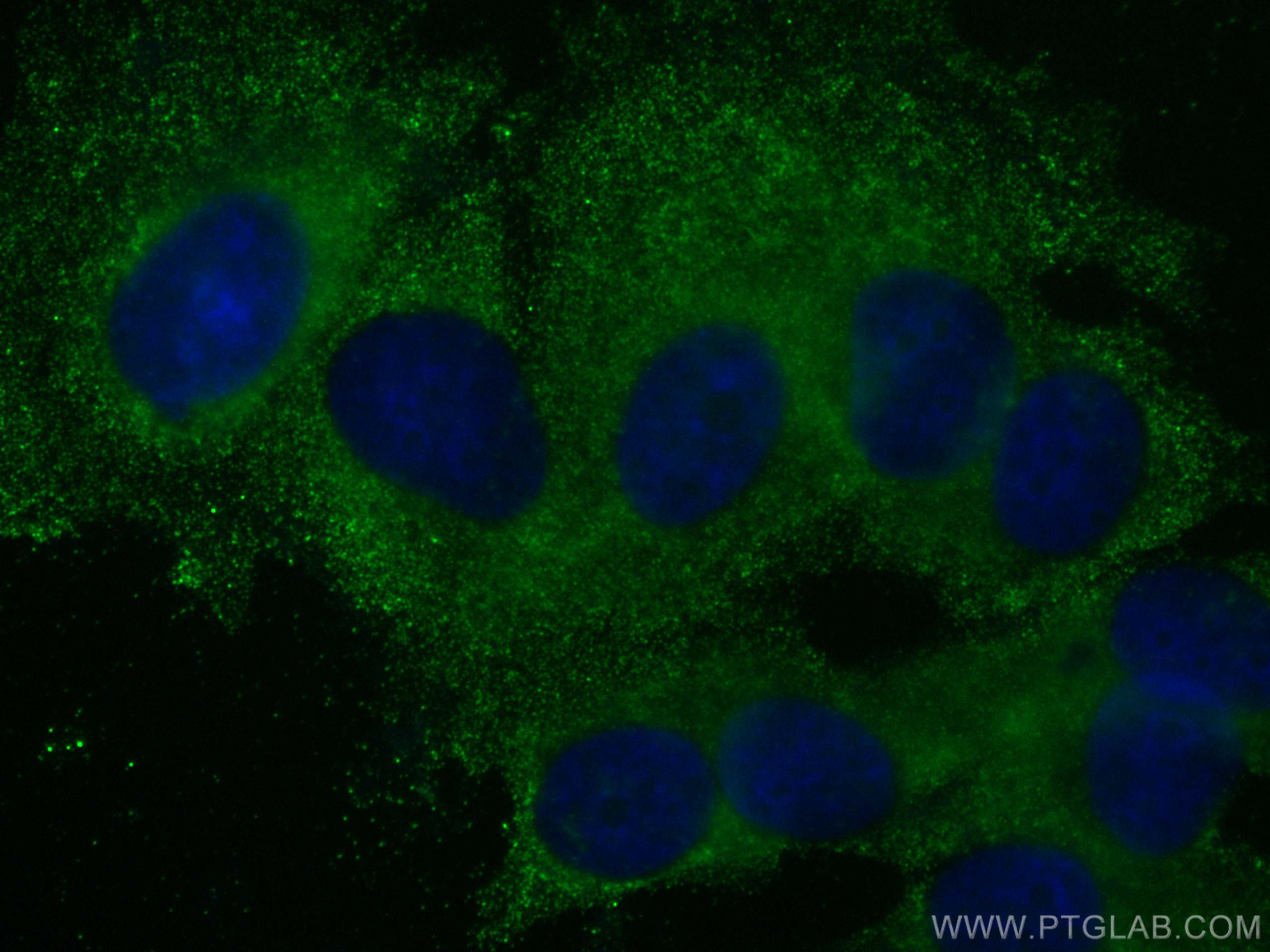 Immunofluorescence (IF) / fluorescent staining of MCF-7 cells using ODC1 Monoclonal antibody (67336-1-Ig)