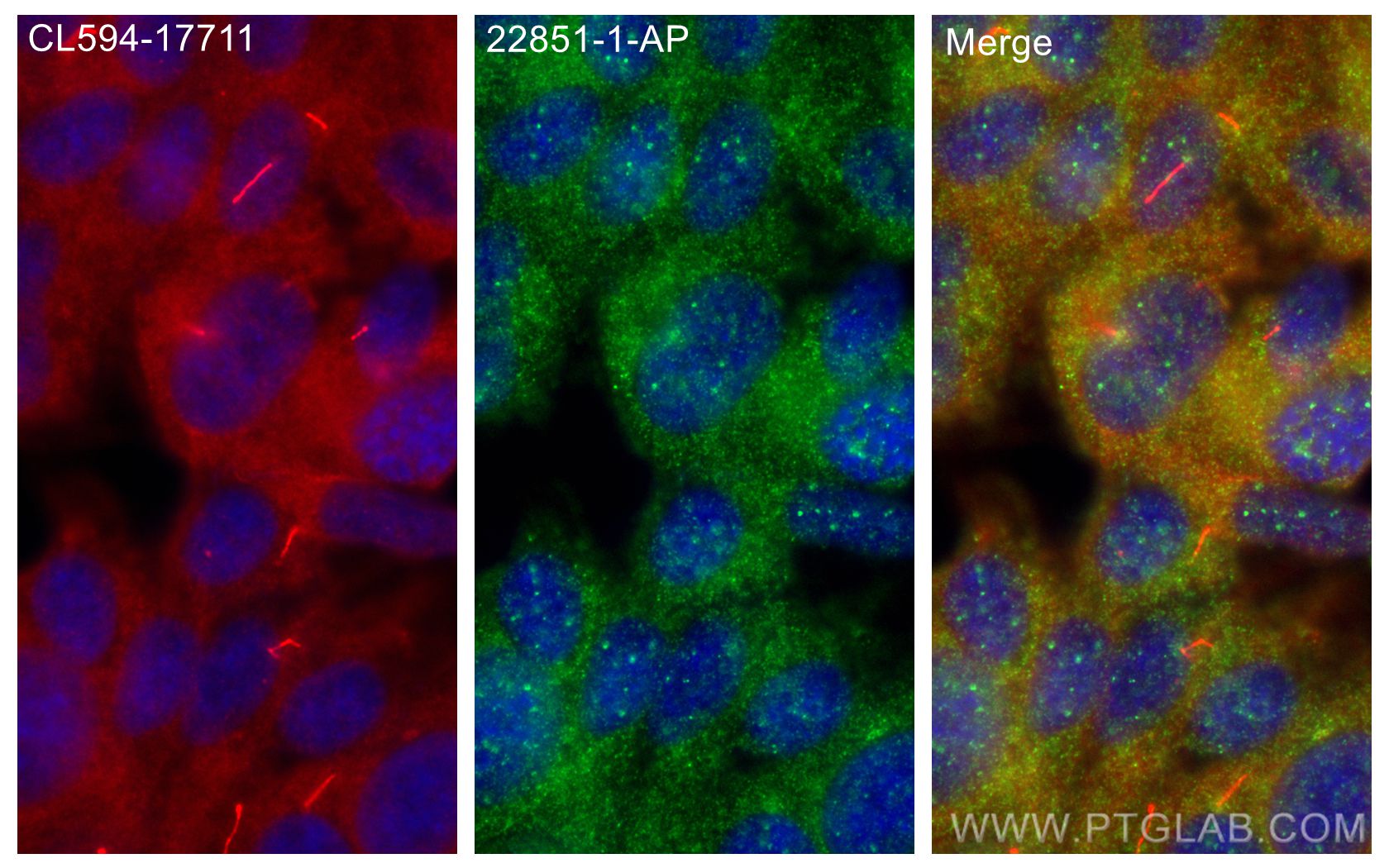 Immunofluorescence (IF) / fluorescent staining of hTERT-RPE1 cells using OFD1 Polyclonal antibody (22851-1-AP)