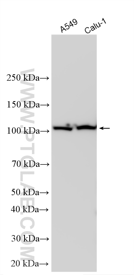Western Blot (WB) analysis of various lysates using OGDH Polyclonal antibody (15212-1-AP)