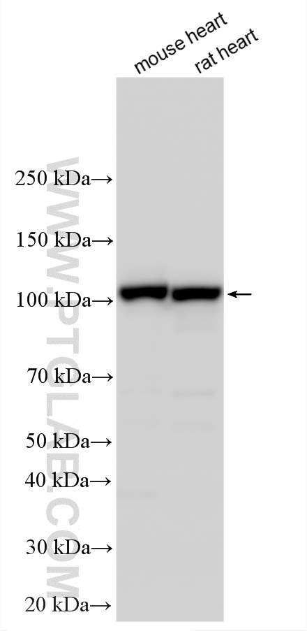 Western Blot (WB) analysis of various lysates using OGDH Polyclonal antibody (15212-1-AP)