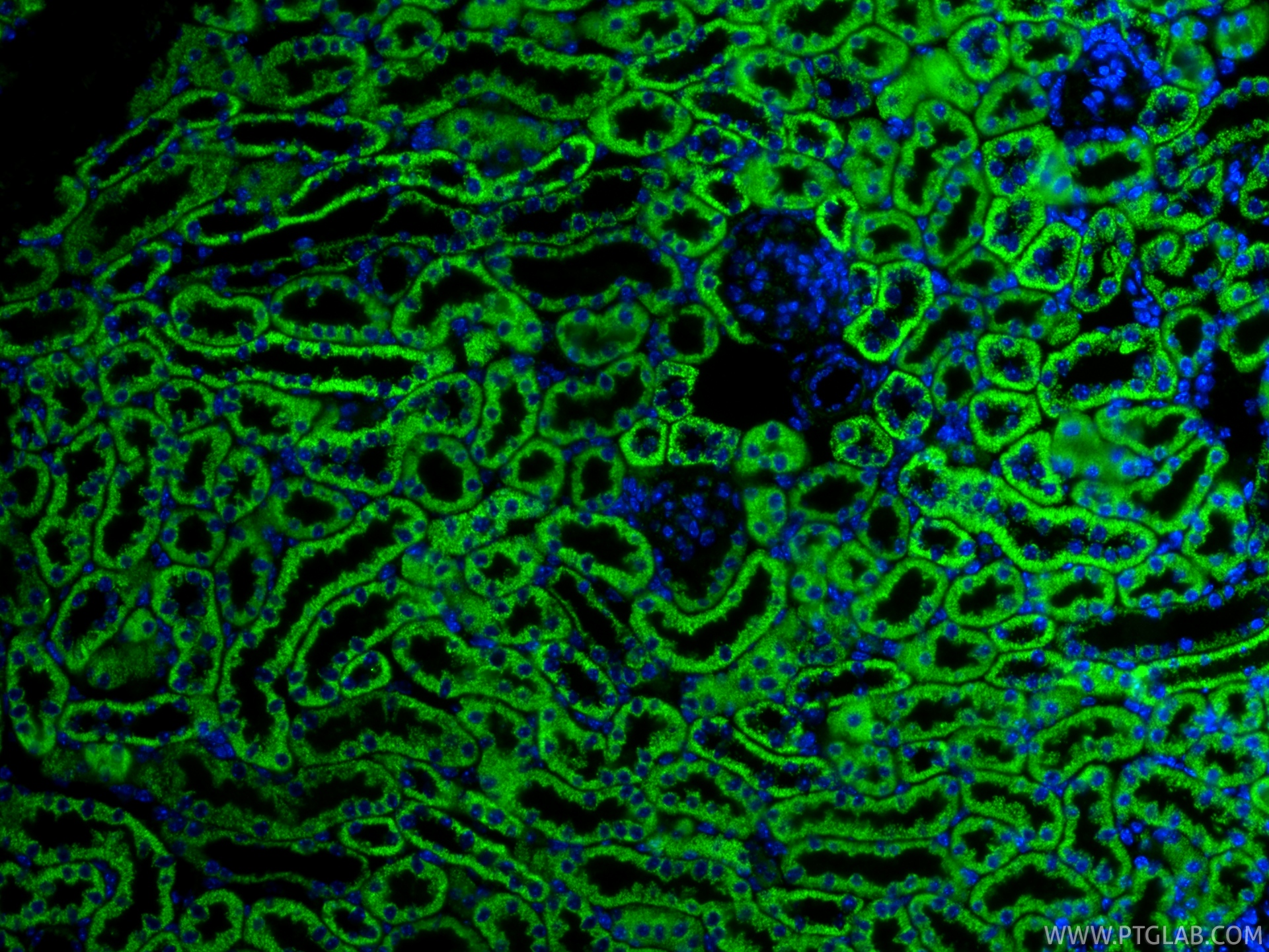 Immunofluorescence (IF) / fluorescent staining of mouse kidney tissue using OGDH Recombinant monoclonal antibody (82773-1-RR)