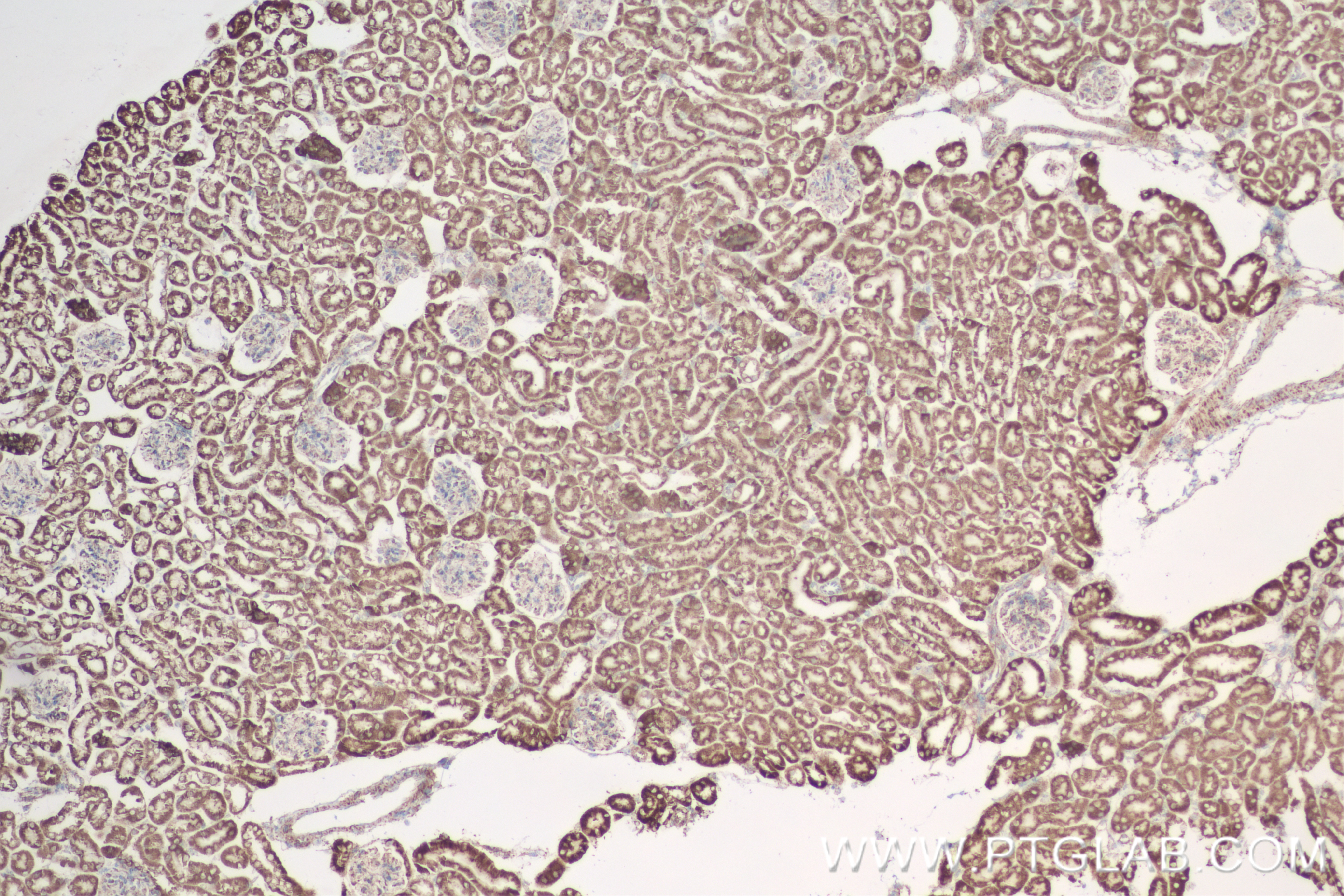 Immunohistochemistry (IHC) staining of mouse kidney tissue using OGDH Recombinant antibody (82773-1-RR)