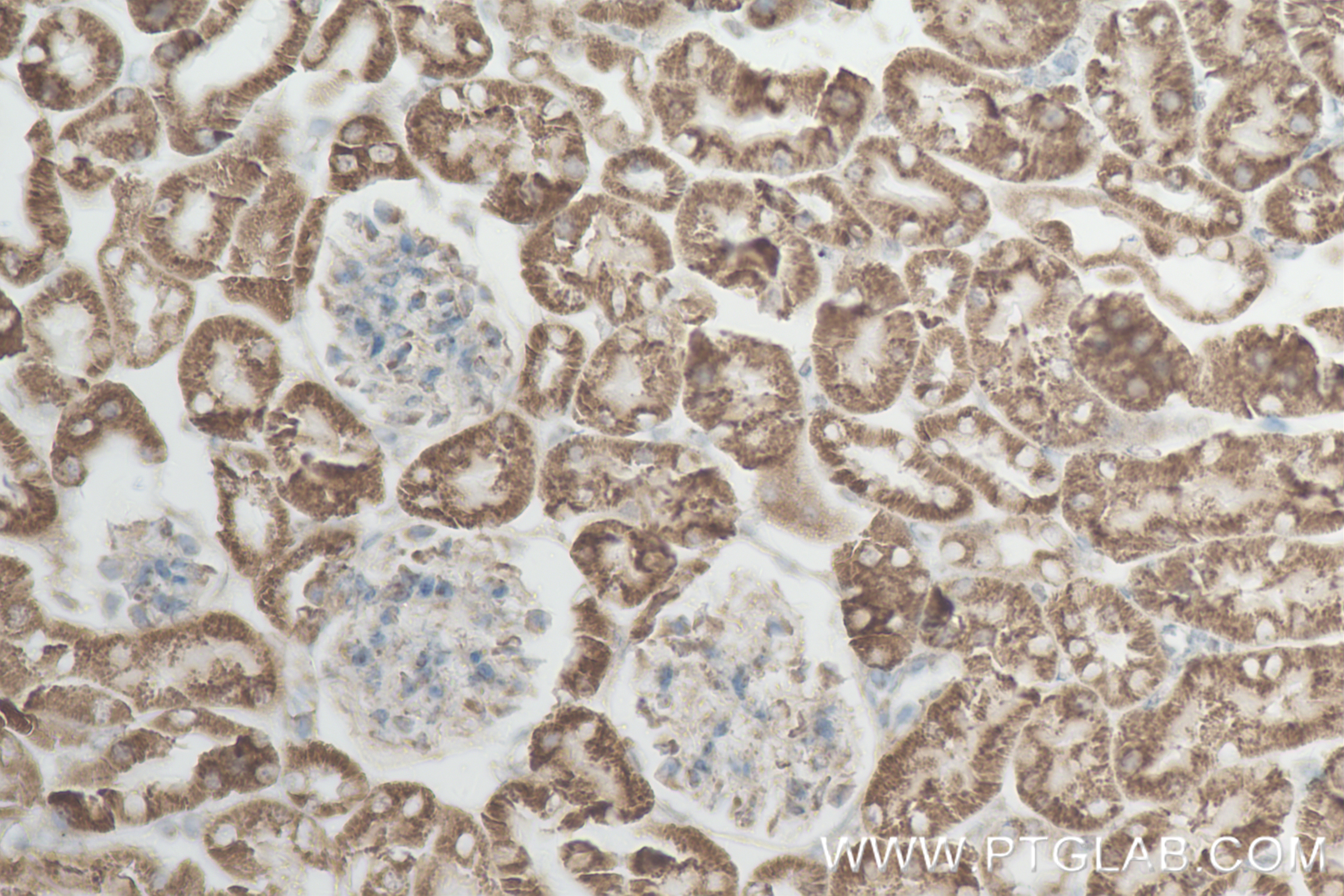 Immunohistochemistry (IHC) staining of mouse kidney tissue using OGDH Recombinant antibody (82773-1-RR)