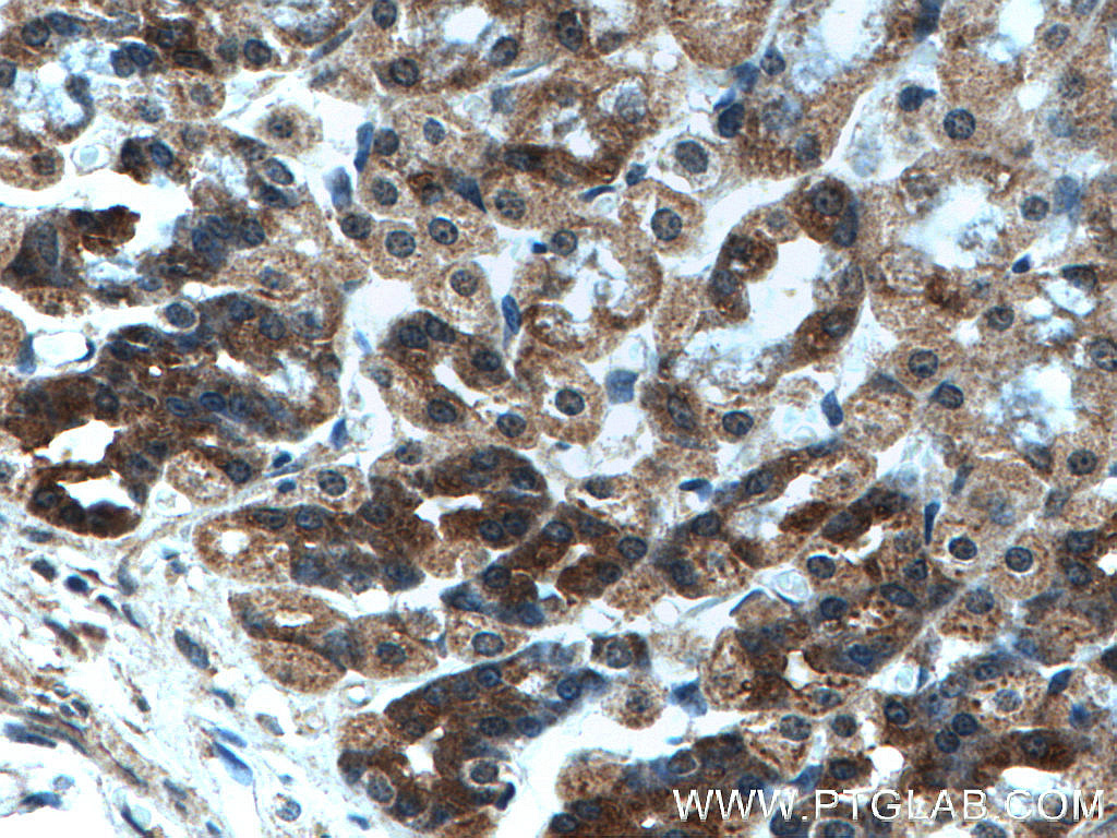 OGT Antibody 11576-2-AP | Proteintech