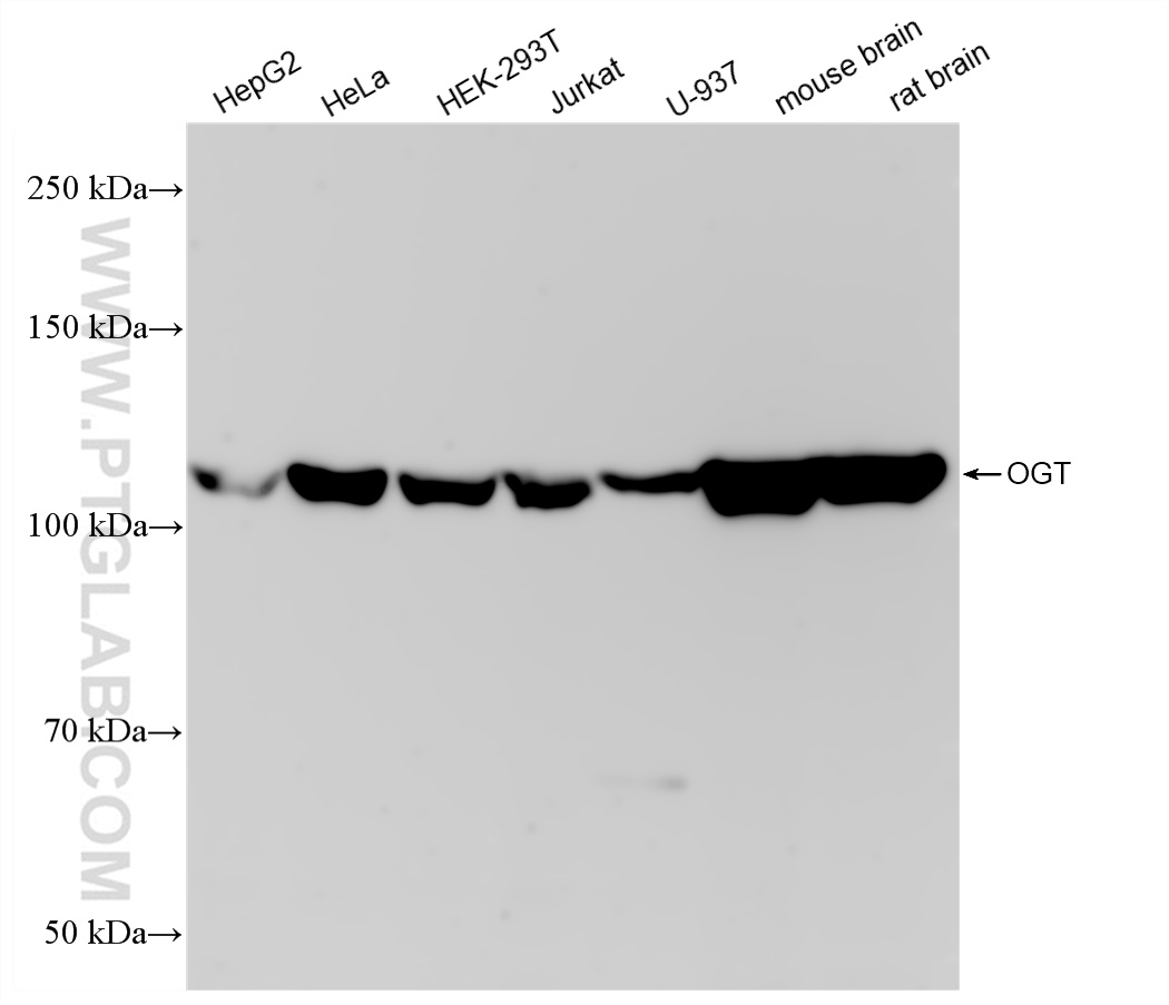 Western Blot (WB) analysis of various lysates using OGT Recombinant antibody (83113-1-RR)