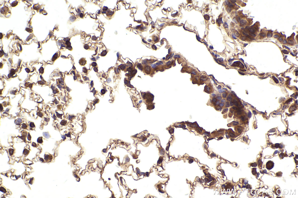 Immunohistochemistry (IHC) staining of mouse lung tissue using hIST1 Polyclonal antibody (19842-1-AP)