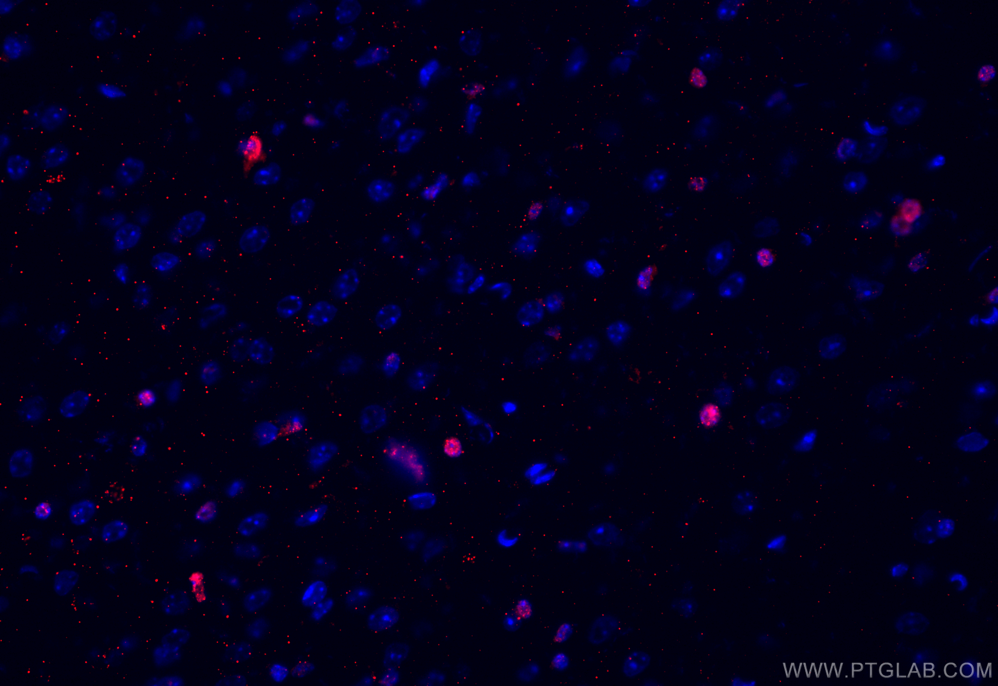 Immunofluorescence (IF) / fluorescent staining of mouse brain tissue using OLIG2 Polyclonal antibody (13999-1-AP)