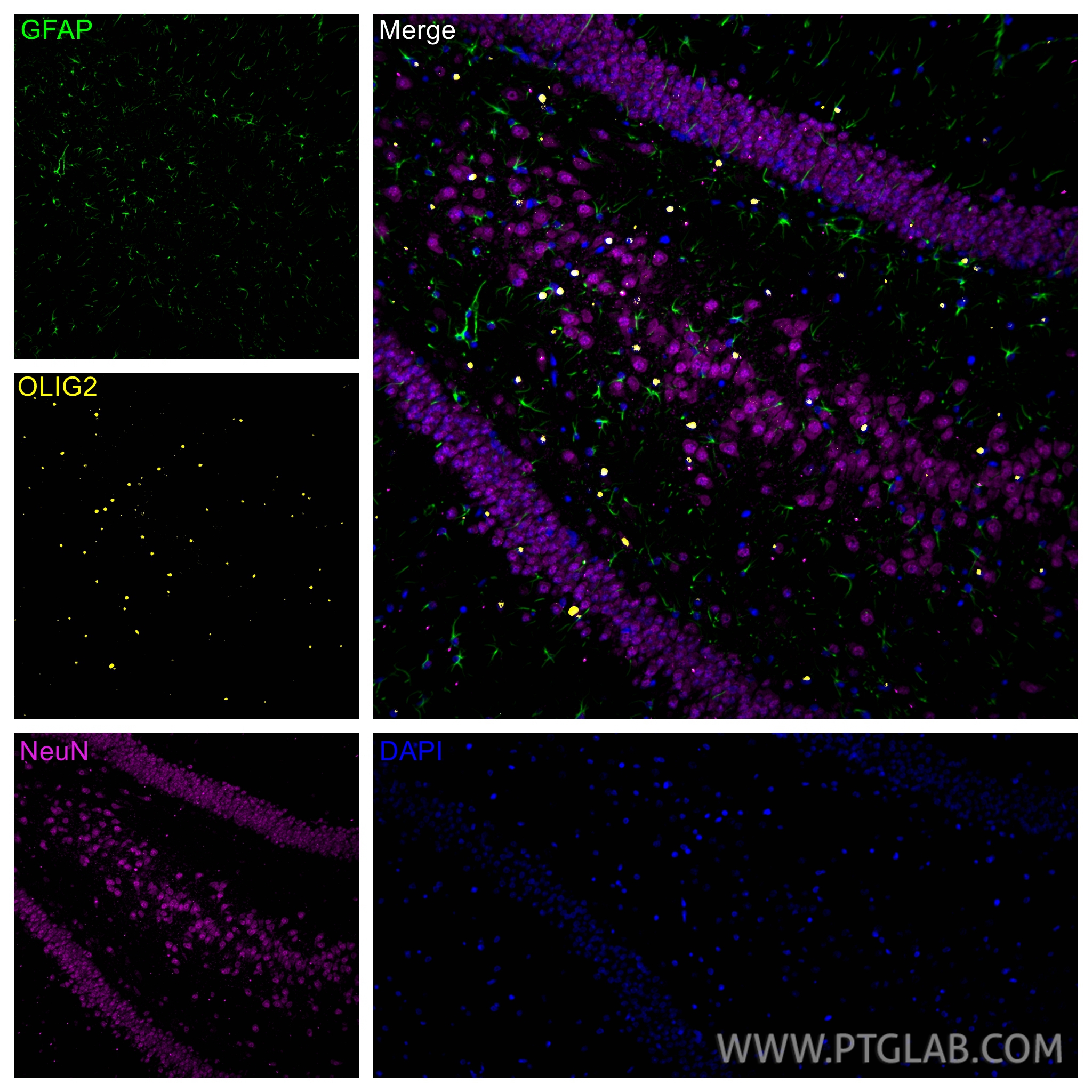 Immunofluorescence (IF) / fluorescent staining of rat brain tissue using OLIG2 Polyclonal antibody (13999-1-AP)