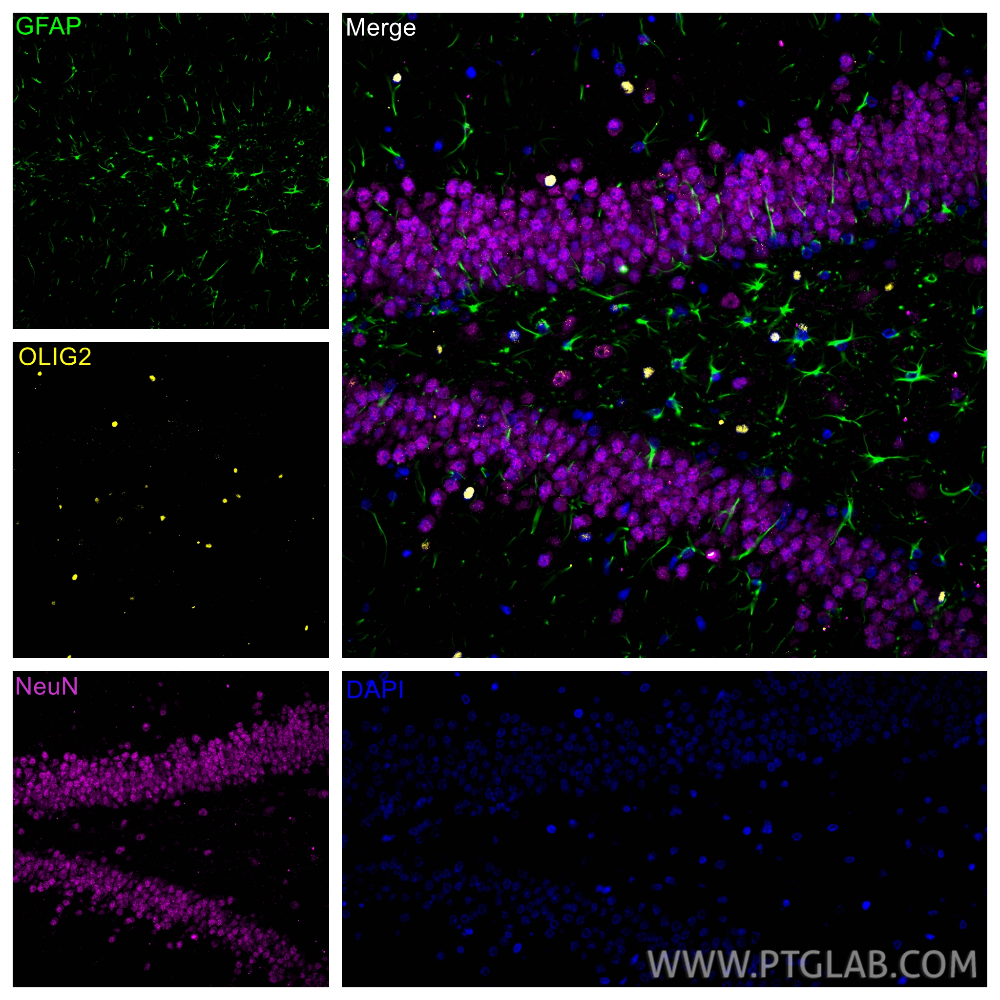 Immunofluorescence (IF) / fluorescent staining of rat brain tissue using OLIG2 Polyclonal antibody (13999-1-AP)