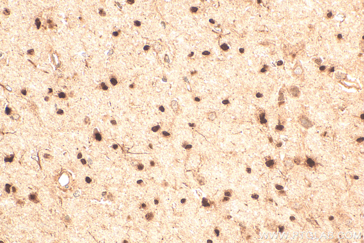 Immunohistochemistry (IHC) staining of rat brain tissue using OLIG2 Polyclonal antibody (13999-1-AP)