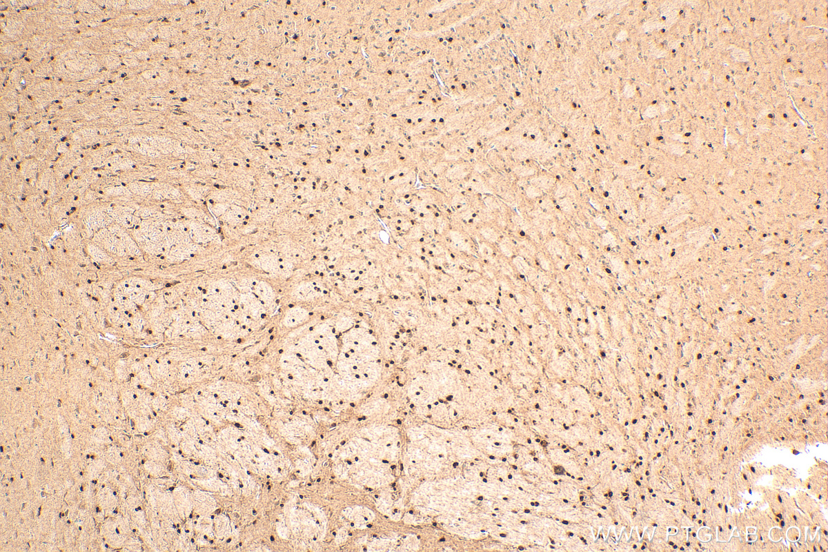 Immunohistochemistry (IHC) staining of mouse brain tissue using OLIG2 Polyclonal antibody (13999-1-AP)