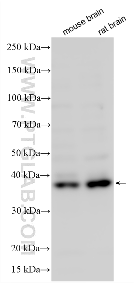 Western Blot (WB) analysis of various lysates using OLIG2 Polyclonal antibody (13999-1-AP)