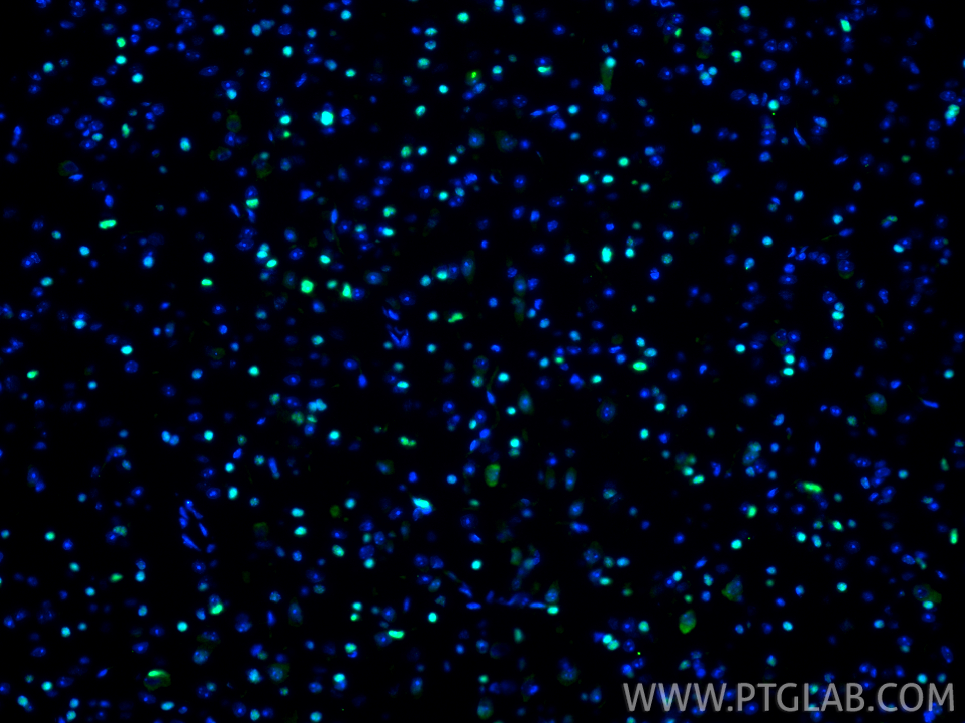 Immunofluorescence (IF) / fluorescent staining of mouse brain tissue using OLIG2 Recombinant antibody (82806-7-RR)