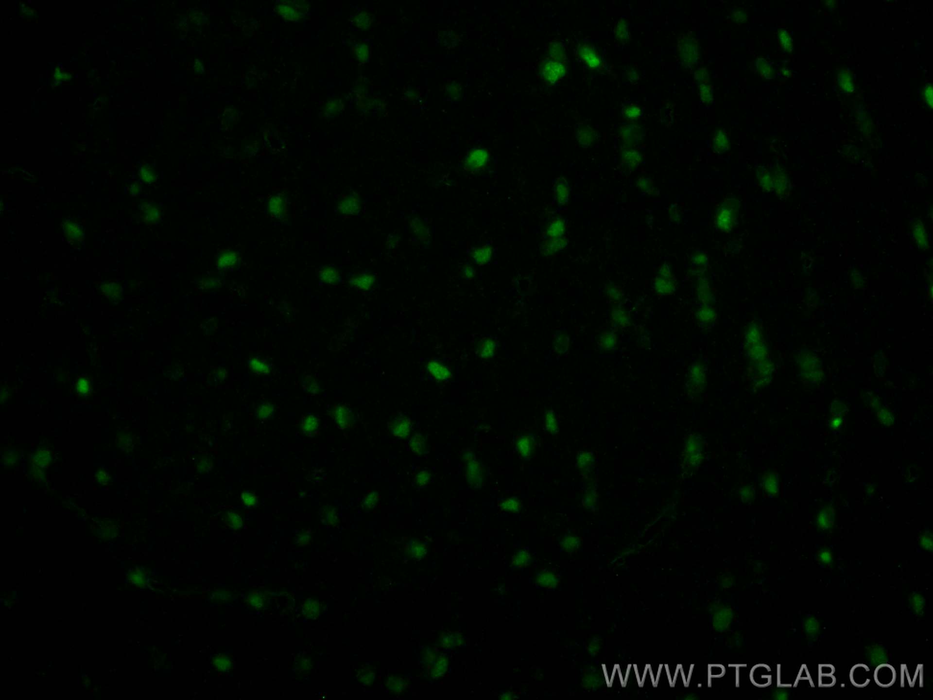 Immunofluorescence (IF) / fluorescent staining of rat brain tissue using CoraLite® Plus 488-conjugated OLIG2 Polyclonal ant (CL488-13999)