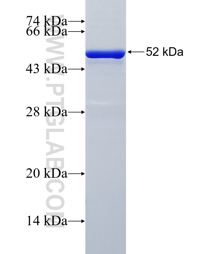 OMD fusion protein Ag27760 SDS-PAGE