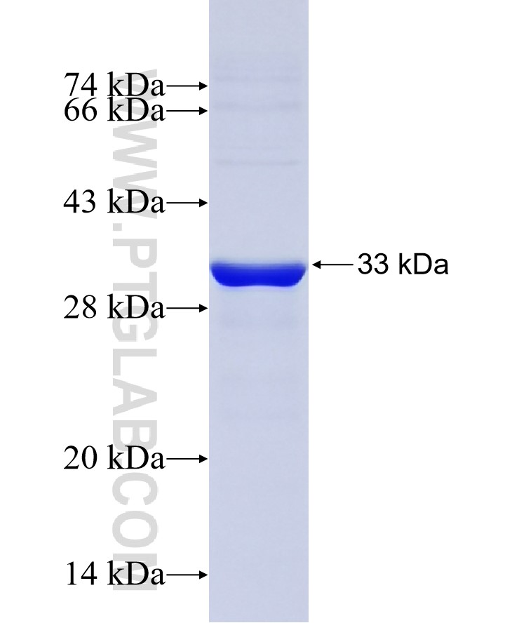 OMD fusion protein Ag27777 SDS-PAGE