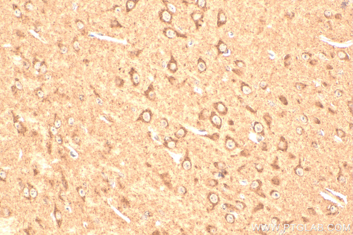 Immunohistochemistry (IHC) staining of mouse brain tissue using OPA1 Polyclonal antibody (27733-1-AP)