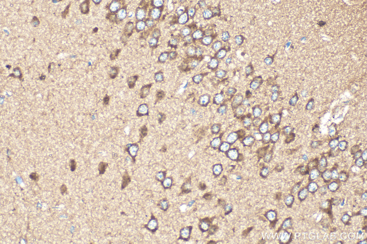 Immunohistochemistry (IHC) staining of mouse brain tissue using OPA1 Polyclonal antibody (27733-1-AP)