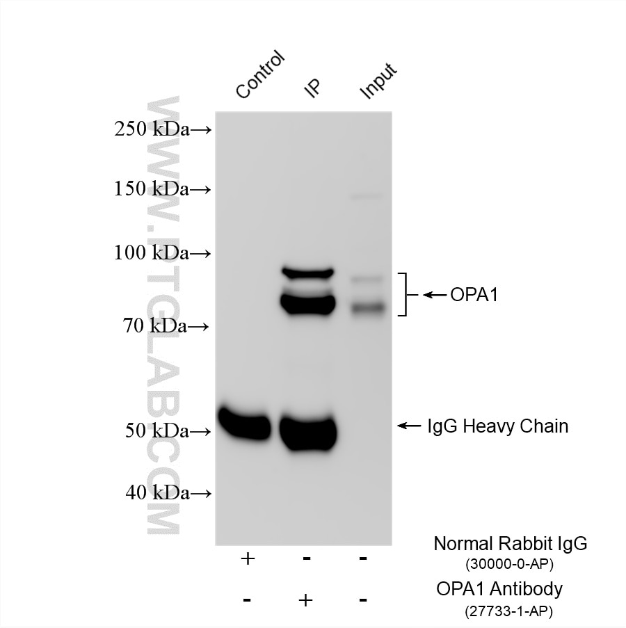 Immunoprecipitation (IP) experiment of mouse brain tissue using OPA1 Polyclonal antibody (27733-1-AP)