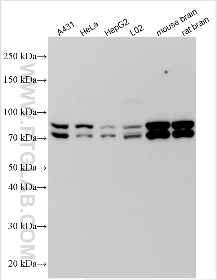 Western Blot (WB) analysis of various lysates using OPA1 Polyclonal antibody (27733-1-AP)