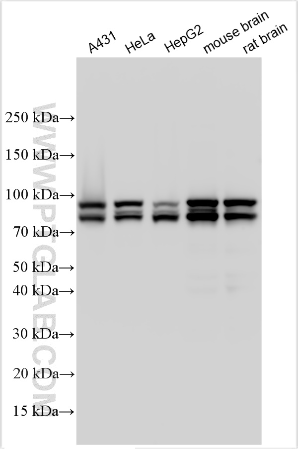 Western Blot (WB) analysis of various lysates using OPA1 Polyclonal antibody (32465-1-AP)