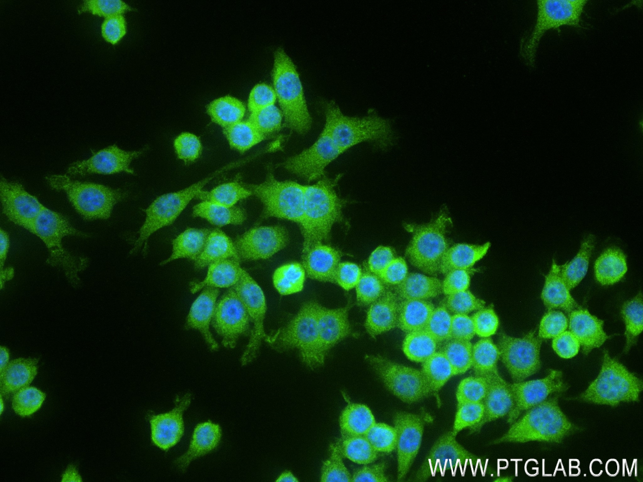 Immunofluorescence (IF) / fluorescent staining of RAW 264.7 cells using Osteopontin Recombinant antibody (83341-1-RR)