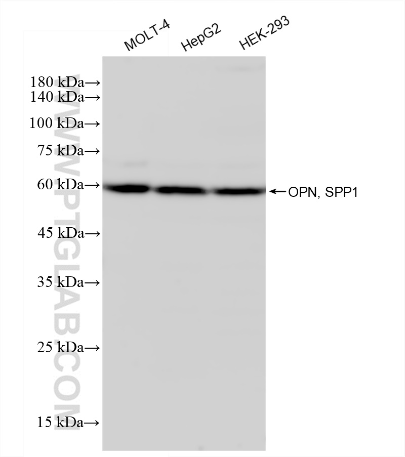 Western Blot (WB) analysis of various lysates using OPN, SPP1 Recombinant antibody (83341-1-RR)