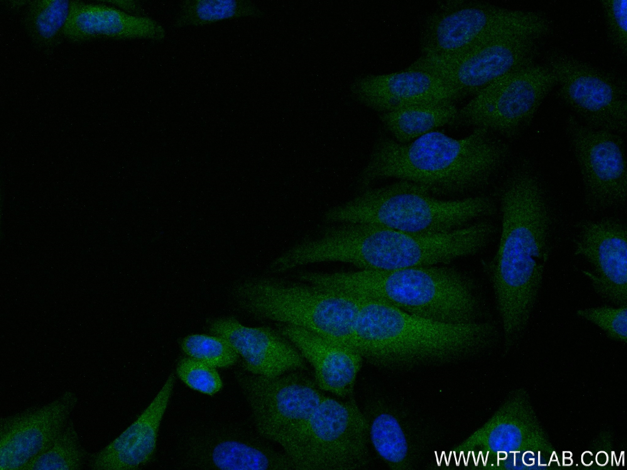 Immunofluorescence (IF) / fluorescent staining of HepG2 cells using OPN, SPP1 Recombinant antibody (83341-2-RR)
