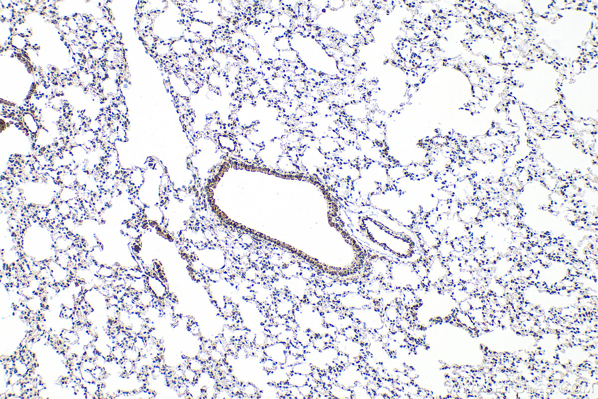 Immunohistochemistry (IHC) staining of mouse lung tissue using Osteopontin Recombinant antibody (83341-2-RR)