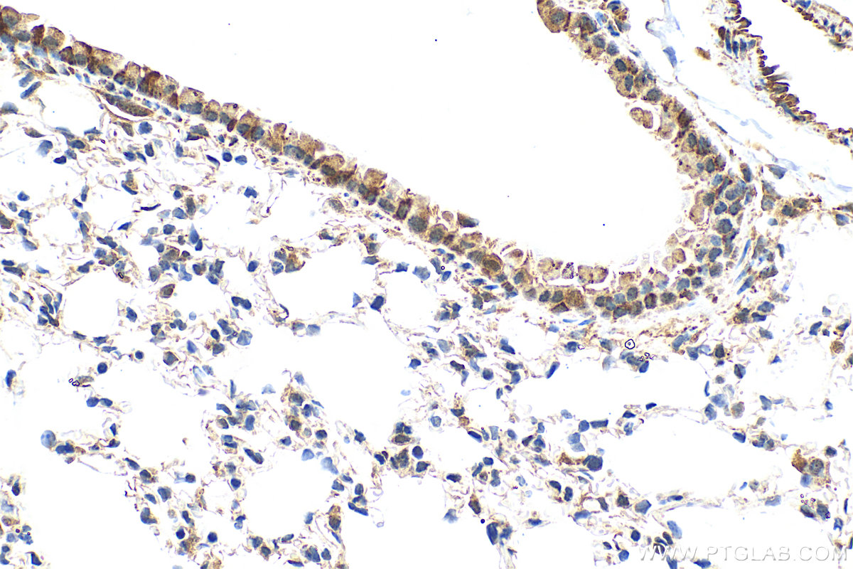 Immunohistochemistry (IHC) staining of mouse lung tissue using Osteopontin Recombinant antibody (83341-2-RR)