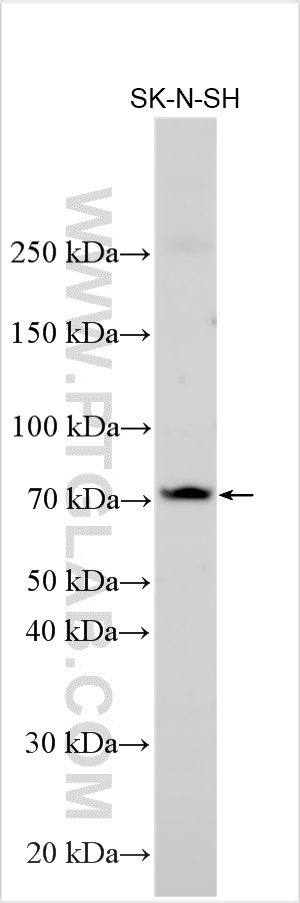 Western Blot (WB) analysis of various lysates using OPRM1 Polyclonal antibody (28887-1-AP)