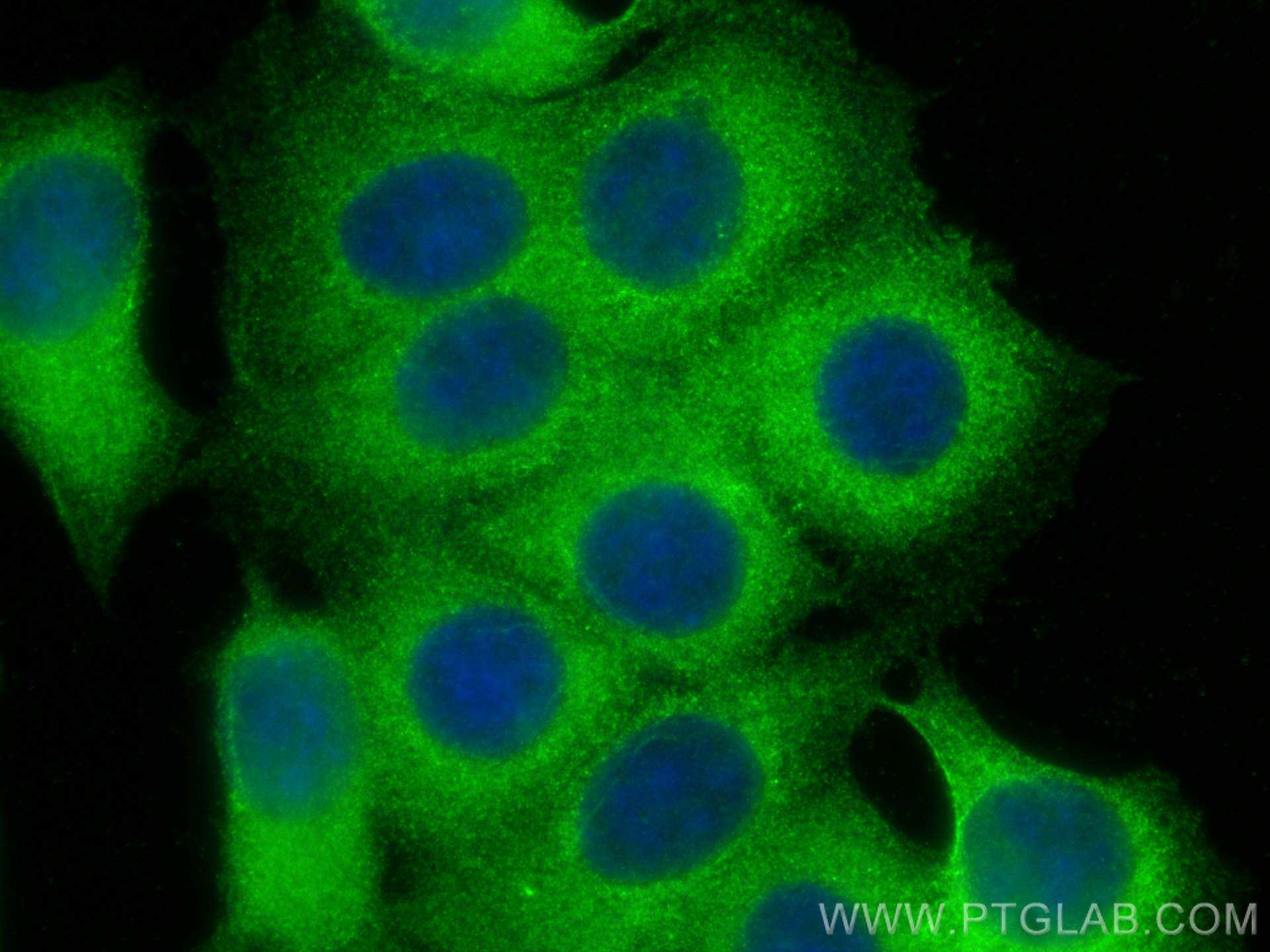 Immunofluorescence (IF) / fluorescent staining of MCF-7 cells using OPTN Polyclonal antibody (10837-1-AP)