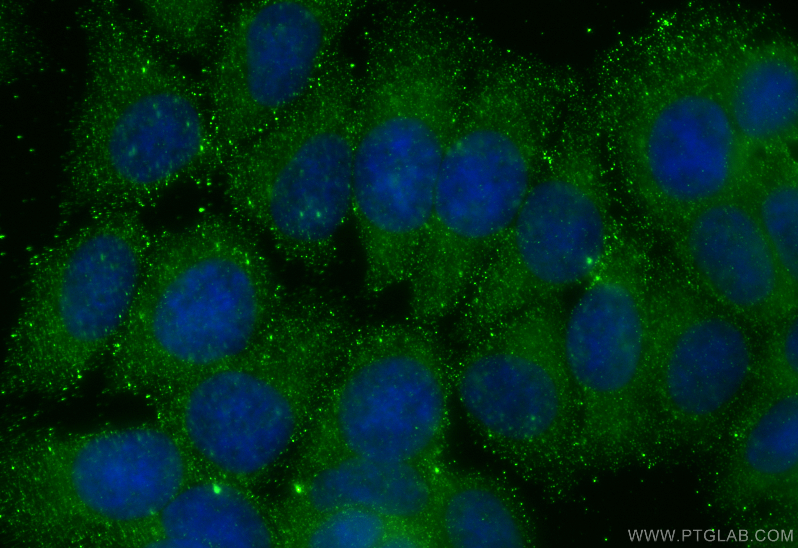 Immunofluorescence (IF) / fluorescent staining of MCF-7 cells using OPTN Monoclonal antibody (60293-1-Ig)