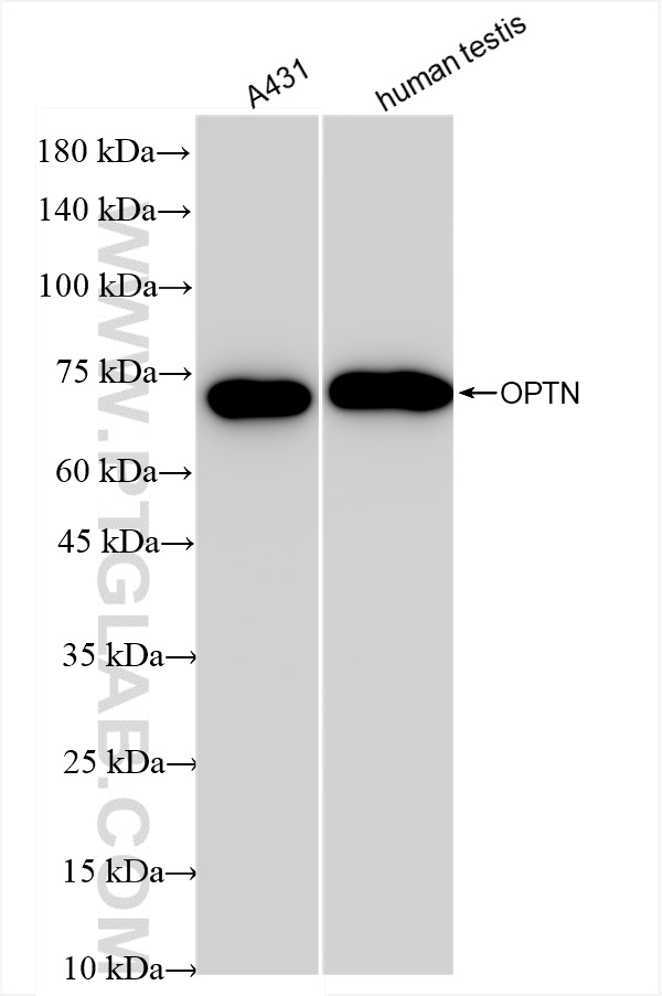 Western Blot (WB) analysis of various lysates using OPTN Recombinant antibody (83634-5-RR)